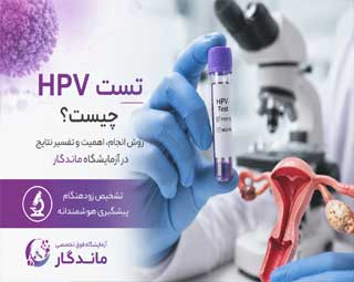 تست HPV چیست؟ | روش انجام، اهمیت و تفسیر نتایج در آزمایشگاه ماندگار